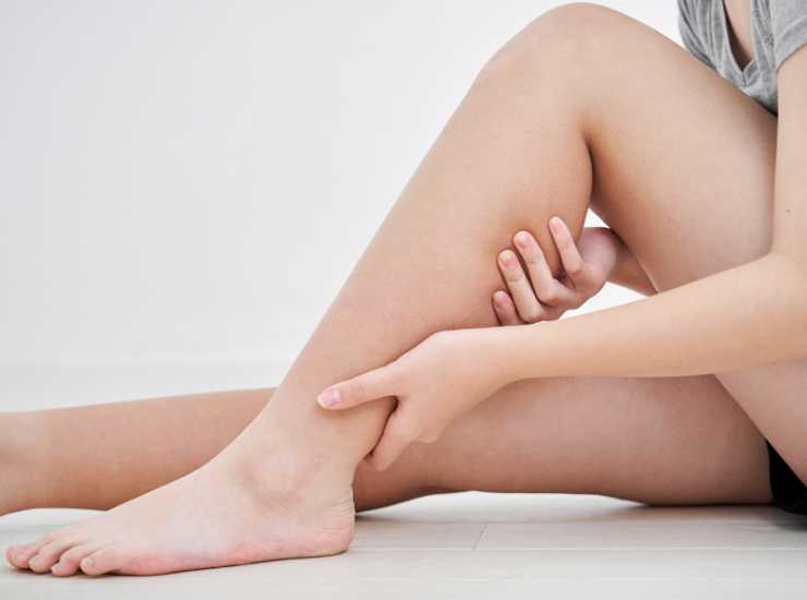 cellulite ritenzione idrica